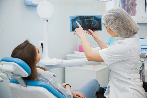 X-ray image of bone grafting at Fairmount Dental Center.